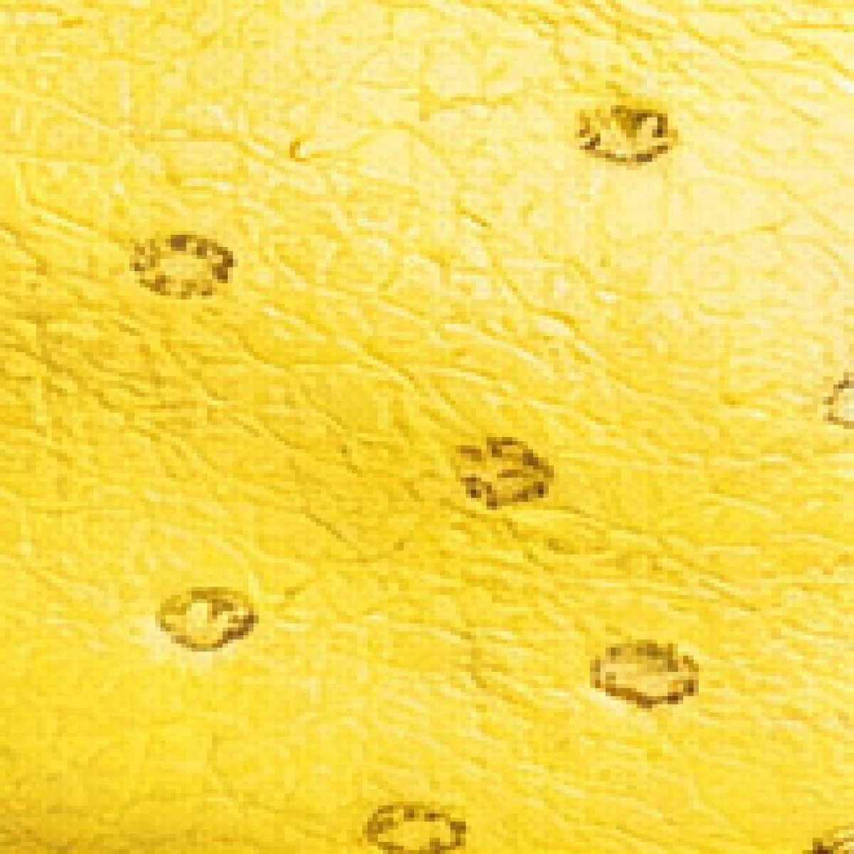 Hermès Birkin Ostrich Leather Bag - صورة 11